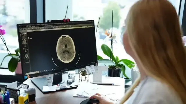 kume bas agrisi nedir belirtileri nelerdir uzmanindan onemli uyarilar mNjx2Gii.webp